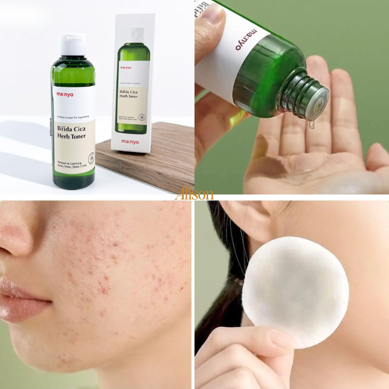 Toner Cho Da Dầu Mụn